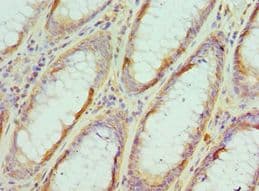 EIF4A1 Antibody (aa167-406)