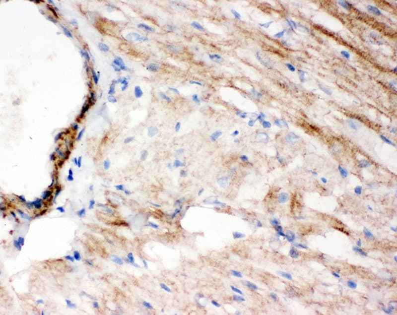 CCN4 / WISP1 Antibody (aa354-367)