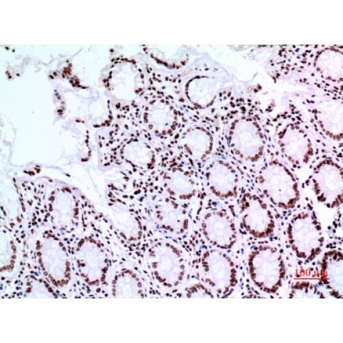 Polyclonal Rabbit anti-Human TP73 / p73 Antibody (IHC, WB)