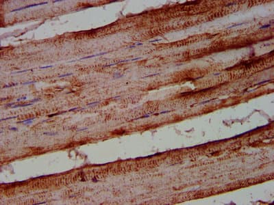 Polyclonal Rabbit anti-Human ALOX12 / 12 Lipoxygenase Antibody (IHC, IF, WB)