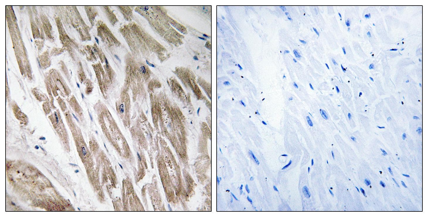 NDUFS5 Antibody