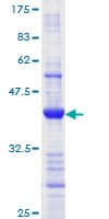 Human MLH1 Protein (Recombinant GST, N-terminus)
