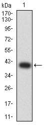 GLRA1/Glycine Receptor Alpha 1 Antibody (clone 7F8E2)