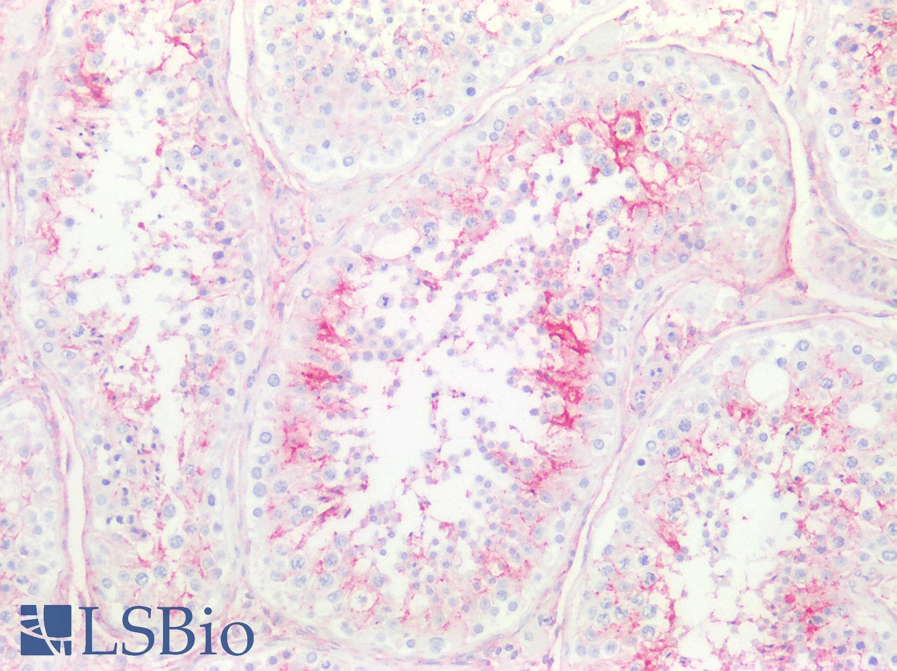 PathPlus™ Monoclonal Mouse anti-Human CD81 Antibody (clone 1.3.3.22, IHC, WB)