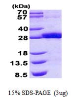Human RDHE2 / SDR16C5 Protein (Recombinant His)