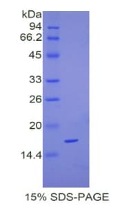 Mouse CPLX2 / Complexin 2 Protein (Recombinant His)