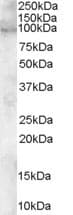 IHC-plus™ ADAM12 Antibody (aa2-14)