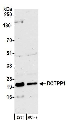 DCTPP1 / XTP3TPA Antibody (aa120-170)