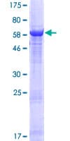 Human ZNF333 Protein (Recombinant GST)