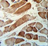 Polyclonal Rabbit anti-Human MMAA Antibody (aa56-84, IHC, WB)