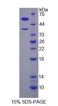 Human H2AFY / MACROH2A1 Protein (Recombinant His-GST)