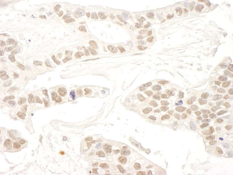 RBM34 Antibody (aa370-430)