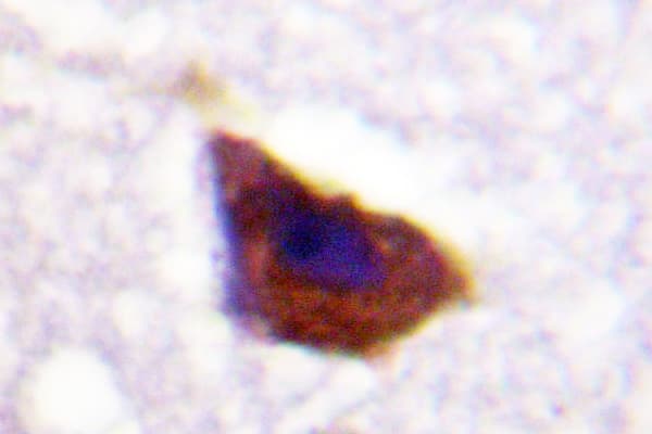 ADRB2 Antibody (Leu342)