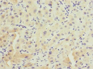 Polyclonal Rabbit anti-Human FHL3 Antibody (IHC)
