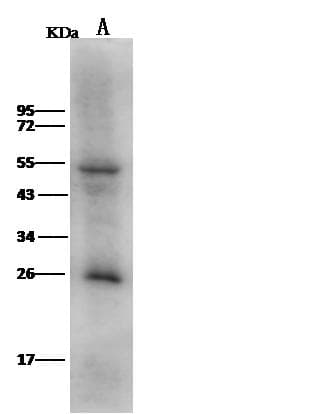 LRRC17 Antibody (Preservative Free)