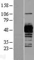 UAP1 Protein (Over-Expression Lysate Myc-DDK (Flag))