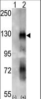 EPHA6 / EPH Receptor A6 Antibody