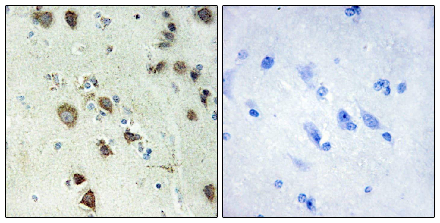 RPS6KA6 / RSK4 Antibody (aa661-710)