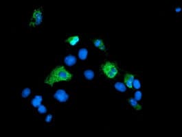 Monoclonal Mouse anti-Human SENP2 Antibody (clone OTI1F7, aa139-523, IF, WB)