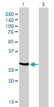 NQO1 Antibody (clone 1E3-A6)
