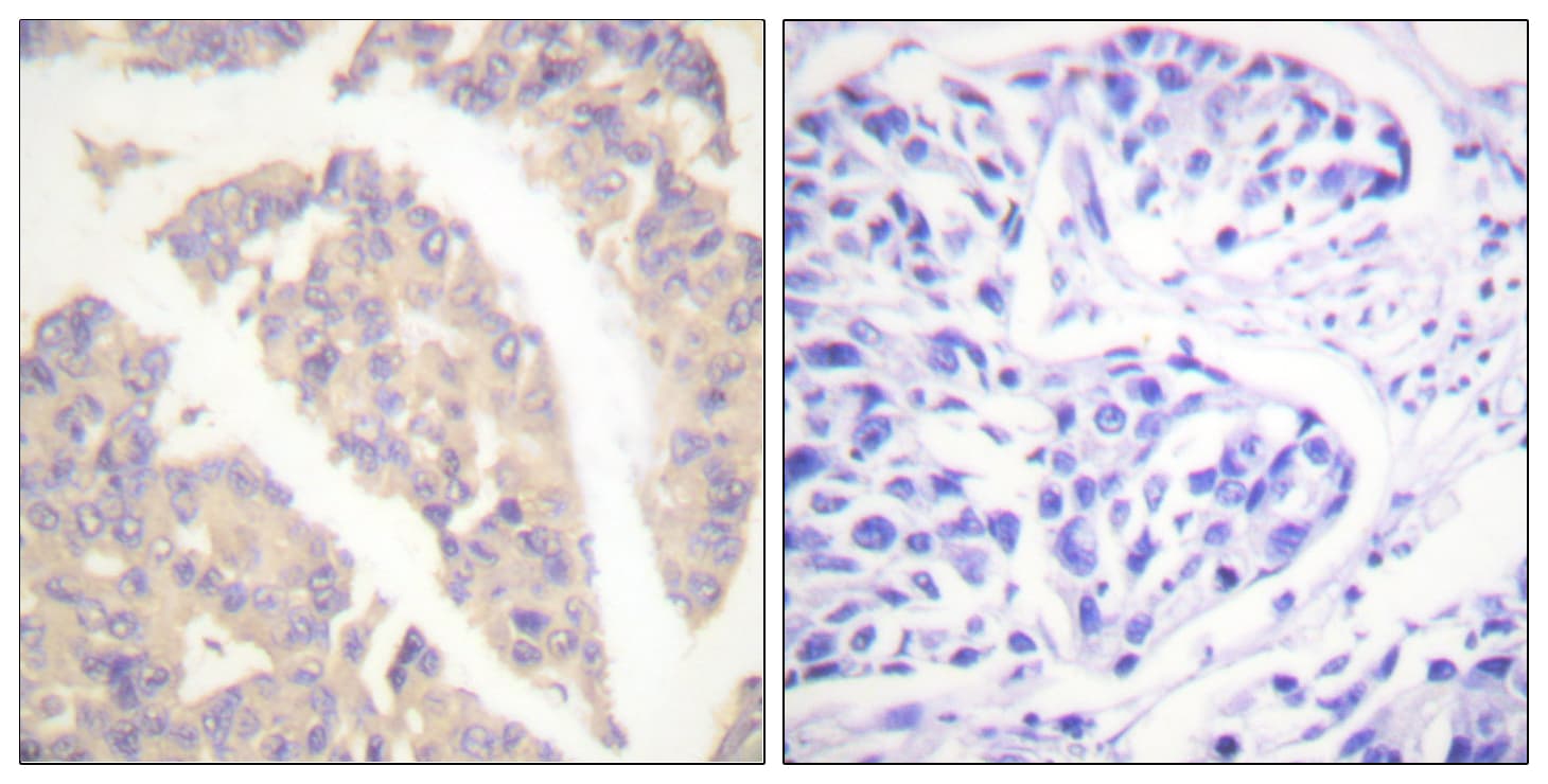 Polyclonal Rabbit anti-Human c-CBL Antibody (aa666-715, IHC, IF, WB)