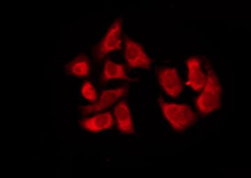 TAS2R8 / T2R8 Antibody