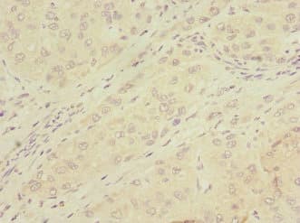 Polyclonal Rabbit anti-Human MMP19 Antibody (IHC, WB)