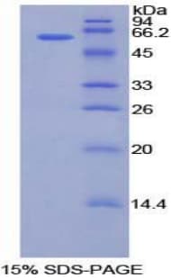 Human CILP Protein (Recombinant His-GST)