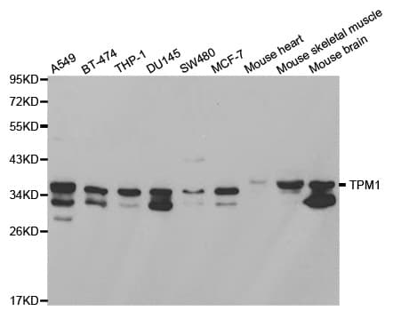 IHC-plus™ Polyclonal Rabbit anti-Human TPM1 / Tropomyosin Antibody (IHC, IF, WB)
