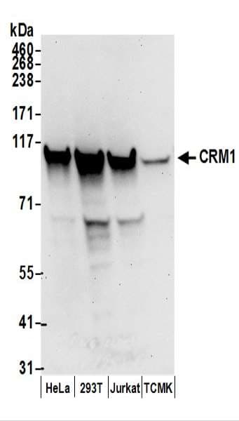 IHC-plus™ Polyclonal Rabbit anti-Human XPO1 / CRM1 Antibody (aa1025-C-term, IHC, WB)