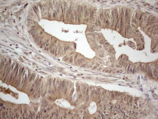 Monoclonal Mouse anti-Human PPP1CA / PP1-Alpha Antibody (clone OTI6E5, IHC, WB)