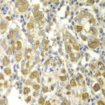 TNF Alpha Antibody