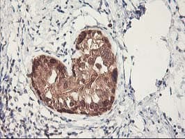 Monoclonal Mouse anti-Human RBBP7 / RbAp46 Antibody (clone OTI5A4, IHC, WB)