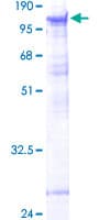 Human PAPOLB Protein (Recombinant GST)