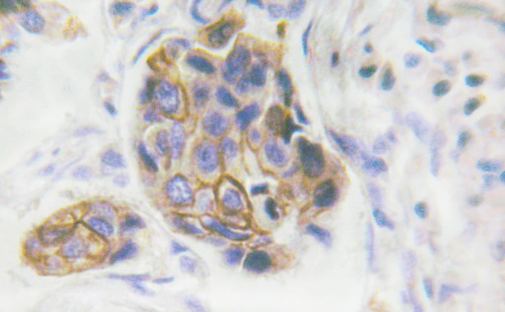 INSR / Insulin Receptor Antibody (phospho-Tyr1361)