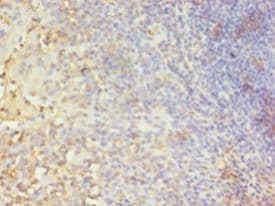 CA-VB / CA5B Antibody (FITC)