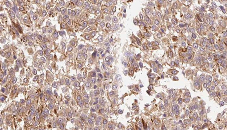 IL3 Antibody