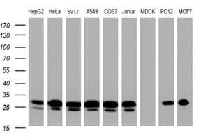 BCL10 / BCL-10 Antibody (clone OTI8G9)