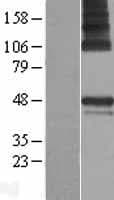 PARS2 Protein (Over-Expression Lysate Myc-DDK (Flag))