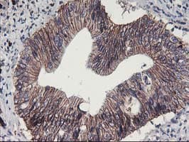 Monoclonal Mouse anti-Human ALOX15 / 15-Lipoxygenase Antibody (clone OTI3G8, IHC, IF, WB)