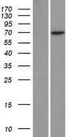 ZNF354C Protein (Over-Expression Lysate Myc-DDK (Flag))
