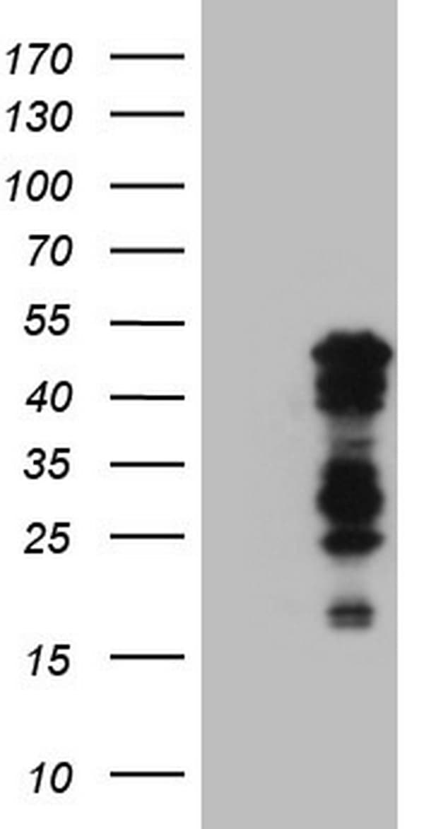 Monoclonal Mouse anti-Human BHLHE41 / BHLHB3 / SHARP1 Antibody (clone OTI10B11, aa1-297, IHC, WB)