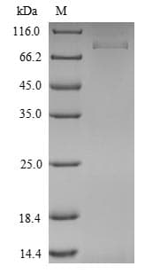 Mouse ISM1 Protein (Recombinant 6His, N-terminus)