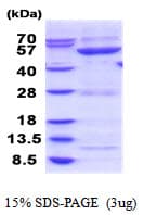 Human GBA3 / CBG Protein (Recombinant His)
