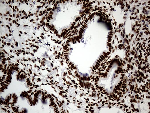 HNRNPH1 / hnRNP H Antibody (clone OTI2E8)