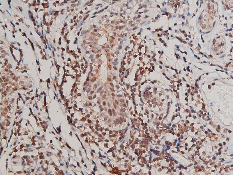 Polyclonal Rabbit anti-Human FLT1 / VEGFR1 Antibody (phospho-Tyr1213, IF, WB)