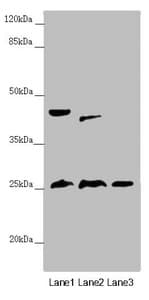 RNF114 / ZNF313 Antibody