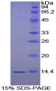 Chicken BDNF Protein (Recombinant His)