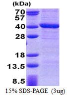 Human PPP4C Protein (Recombinant His)
