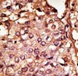 ACKR2 / CCR10 / D6 Antibody (aa54-84)
